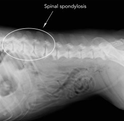Spine Spondylosisup